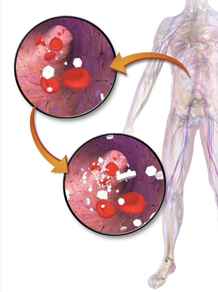 Hemoglobin a1c.
